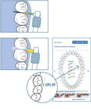 CURAPROX medzizubné kefky - Ako zubní lekári určujú správnu veľkosť